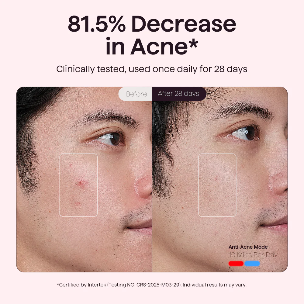 Radiant Skin Duo - Image 5